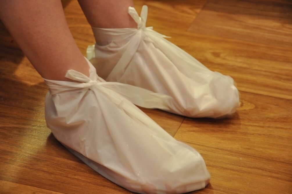 comprese pentru artroza gleznei