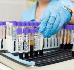 test de sânge pentru a diagnostica durerile articulare