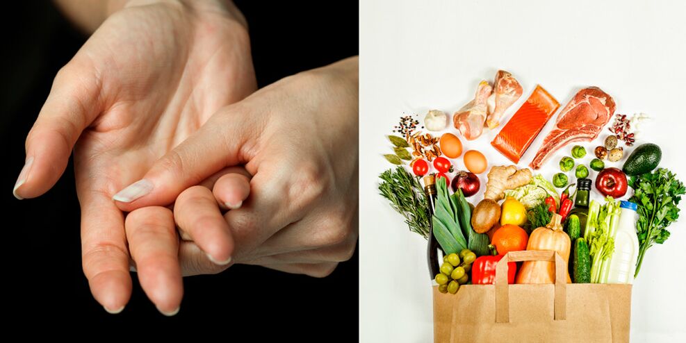 artrită gută a mâinilor și a alimentelor pentru tratamentul acesteia
