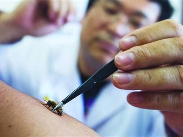 apiterapie pentru osteocondroza cervicală