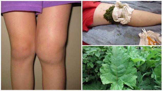 compresă pe bază de plante pentru osteoartrita genunchiului